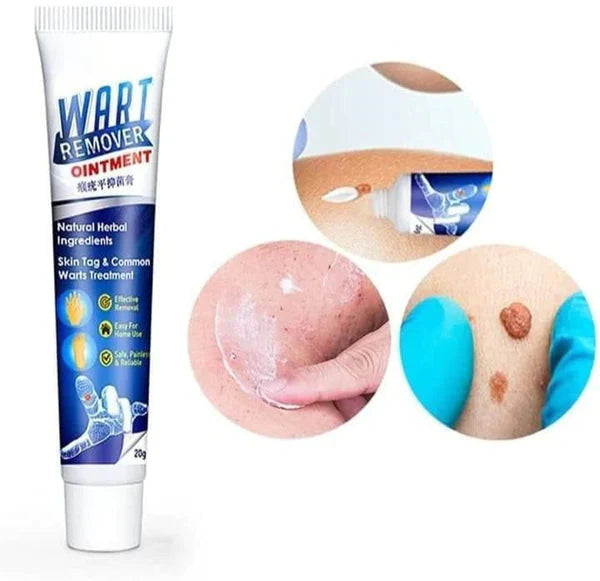 Instant Wart-Remover Ointment ( 100g )